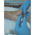 Lesboek - Diabetische Voet